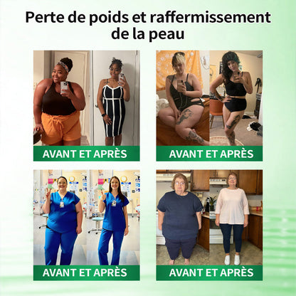 🇫🇷𝑷𝒂𝒕𝒄𝒉 𝑴é𝒕𝒂𝒃𝒐𝒍𝒊𝒒𝒖𝒆 𝗚𝗙𝗢𝗨𝗞® 10-𝒆𝒏-1 : 𝑩𝒓û𝒍𝒆-𝑮𝒓𝒂𝒊𝒔𝒔𝒆 𝑰𝒏𝒕𝒆𝒏𝒔𝒊𝒇 (𝑨𝑪𝑽 × 𝑬𝑮𝑪𝑮) + 𝑴𝒂𝒕𝒓𝒊𝒙𝒚𝒍™ 3000 𝑺𝒄𝒖𝒍𝒑𝒕𝒂𝒏𝒕👗 (𝐔𝐧𝐞 𝐬𝐞𝐮𝐥𝐞 𝐟𝐨𝐢𝐬 𝐩𝐚𝐫 𝐣𝐨𝐮𝐫, 𝐜𝐡𝐚𝐧𝐠𝐞𝐦𝐞𝐧𝐭𝐬 𝐯𝐢𝐬𝐢𝐛𝐥𝐞𝐬 𝐞𝐧 𝟕 𝐣𝐨𝐮𝐫𝐬) ✅𝐏𝐨𝐮𝐫 𝐥’𝐨𝐛é𝐬𝐢𝐭é, 🅟🅔🅐🅤 🅡🅔🅛â🅒🅗é🅔,𝐝𝐢𝐚𝐛è𝐭𝐞, 𝐚𝐩𝐧é𝐞 𝐝𝐮 𝐬𝐨𝐦𝐦𝐞𝐢𝐥, 𝐩𝐫𝐨𝐛𝐥è𝐦𝐞𝐬 𝐚𝐫𝐭𝐢𝐜𝐮𝐥𝐚𝐢𝐫𝐞𝐬, 𝐞𝐭 𝐛𝐢𝐞𝐧 𝐩𝐥𝐮𝐬