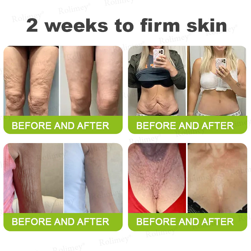 🇬🇧Made and shipped from the UK 🎁Rоlimеу® Botox & Vita-A Retinol Shot Wrinkle-Lift Tightening cream - Last Day Promotion 70% OFF