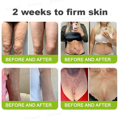 🇬🇧Made and shipped from the UK 🎁Rоlimеу® Botox & Vita-A Retinol Shot Wrinkle-Lift Tightening cream - Last Day Promotion 70% OFF