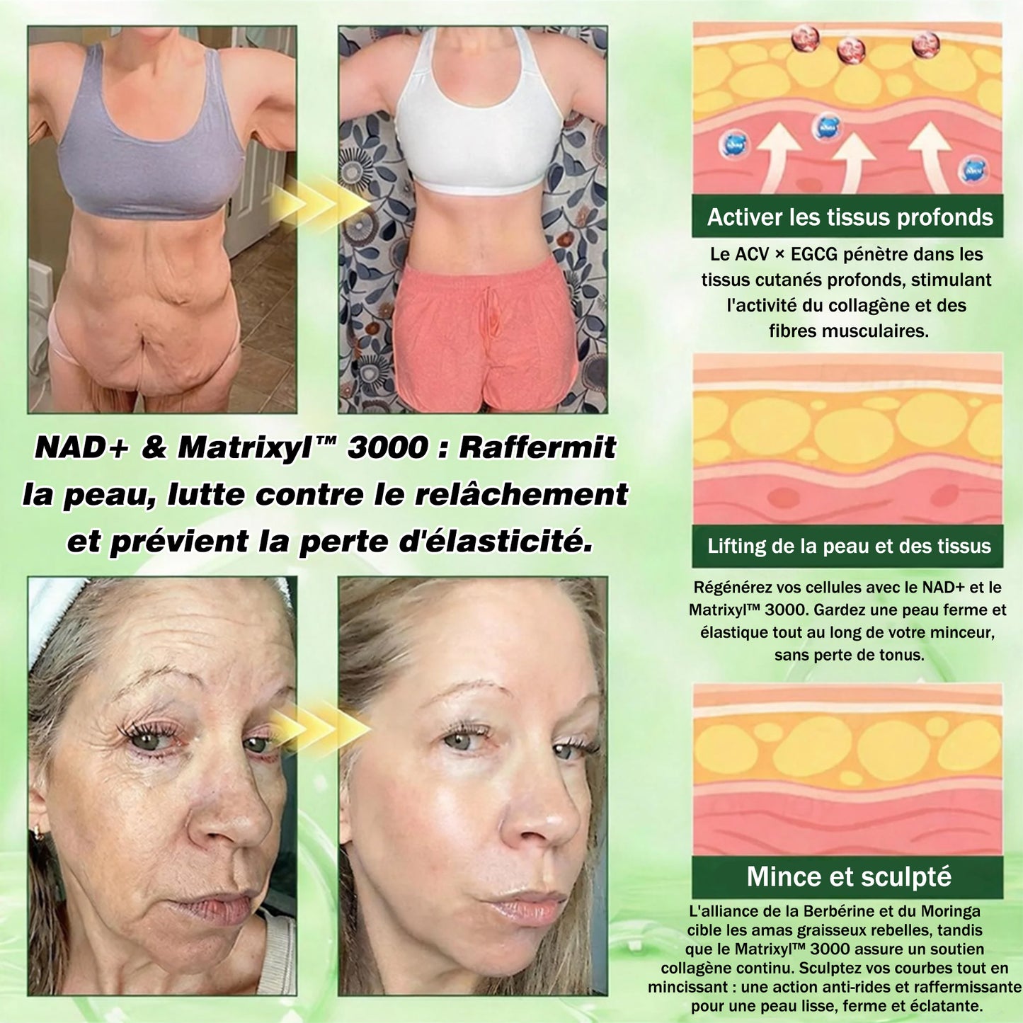 🇫🇷𝑷𝒂𝒕𝒄𝒉 𝑴é𝒕𝒂𝒃𝒐𝒍𝒊𝒒𝒖𝒆 𝗚𝗙𝗢𝗨𝗞® 10-𝒆𝒏-1 : 𝑩𝒓û𝒍𝒆-𝑮𝒓𝒂𝒊𝒔𝒔𝒆 𝑰𝒏𝒕𝒆𝒏𝒔𝒊𝒇 (𝑨𝑪𝑽 × 𝑬𝑮𝑪𝑮) + 𝑴𝒂𝒕𝒓𝒊𝒙𝒚𝒍™ 3000 𝑺𝒄𝒖𝒍𝒑𝒕𝒂𝒏𝒕👗 (𝐔𝐧𝐞 𝐬𝐞𝐮𝐥𝐞 𝐟𝐨𝐢𝐬 𝐩𝐚𝐫 𝐣𝐨𝐮𝐫, 𝐜𝐡𝐚𝐧𝐠𝐞𝐦𝐞𝐧𝐭𝐬 𝐯𝐢𝐬𝐢𝐛𝐥𝐞𝐬 𝐞𝐧 𝟕 𝐣𝐨𝐮𝐫𝐬) ✅𝐏𝐨𝐮𝐫 𝐥’𝐨𝐛é𝐬𝐢𝐭é, 🅟🅔🅐🅤 🅡🅔🅛â🅒🅗é🅔,𝐝𝐢𝐚𝐛è𝐭𝐞, 𝐚𝐩𝐧é𝐞 𝐝𝐮 𝐬𝐨𝐦𝐦𝐞𝐢𝐥, 𝐩𝐫𝐨𝐛𝐥è𝐦𝐞𝐬 𝐚𝐫𝐭𝐢𝐜𝐮𝐥𝐚𝐢𝐫𝐞𝐬, 𝐞𝐭 𝐛𝐢𝐞𝐧 𝐩𝐥𝐮𝐬