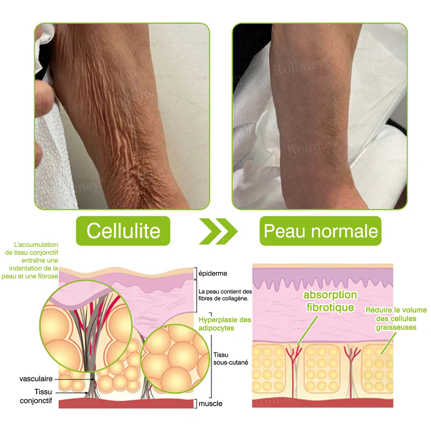 🫶 Profitez de -30% sur le 2ème article 🧡