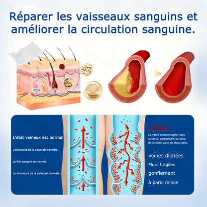 GFOUК® VeinEase : Patchs Micro-aiguilles ⌛Soulagement Immédiat, Résultats Durables👨‍⚕️🔥